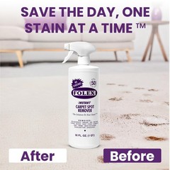 Instant Carpet Spot Remover 128 oz – Powerful Stain Remover for Carpets, Upho…