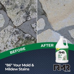 RMR-86 Instant Mold and Mildew Stain Remover Spray – Scrub Free Formula, 1…