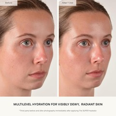 U Beauty The SUPER Hydrator – Mega-Dose Skin Hydrator and Hyaluronic Acid Mois